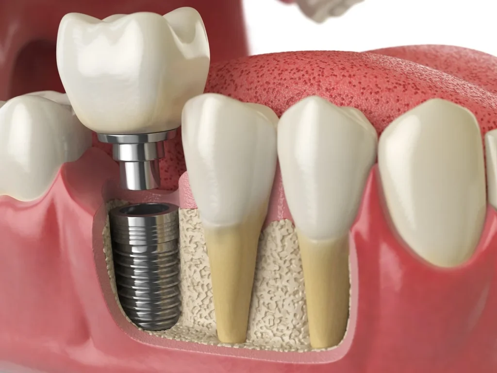 Clínica Canova - os melhores dentistas