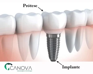 Clínica Canova - Os melhores dentistas